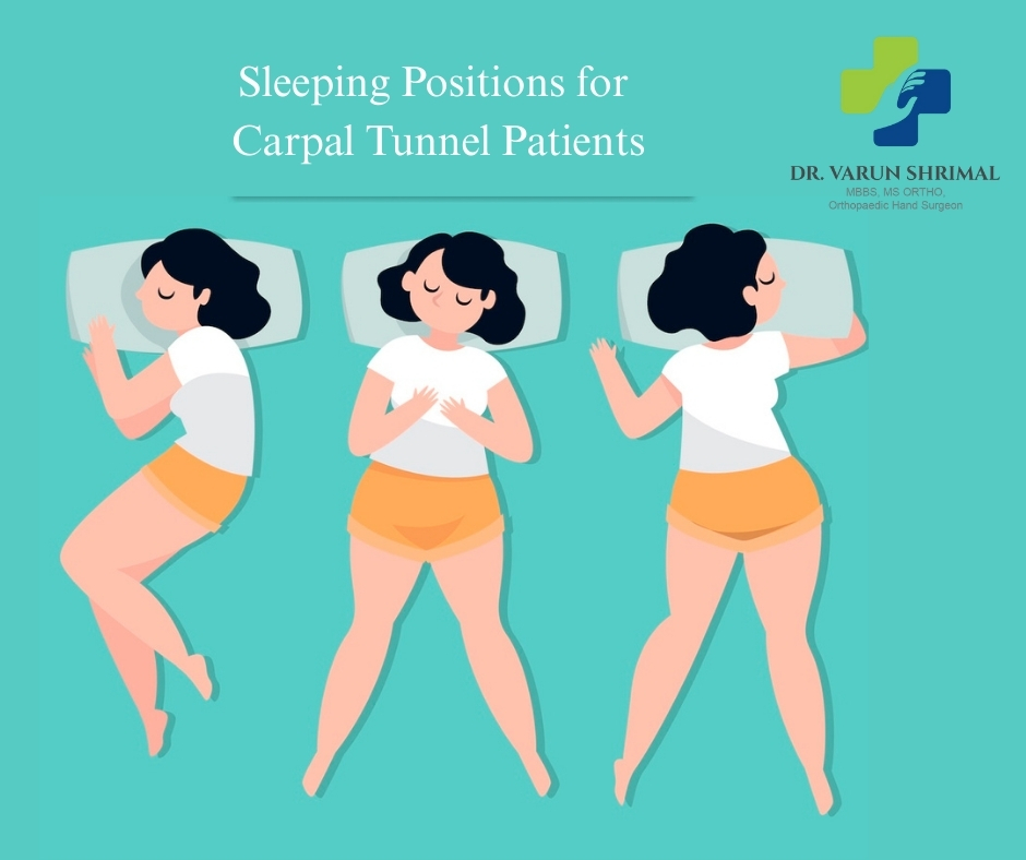Best Sleeping Positions for Carpal Tunnel Patients
