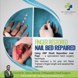 Finger Injury surgery